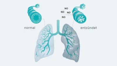 Zuversichtlich-aussehender Arzt an Schreibtisch sitzend mit Vivatmo pro im Hintergrund, hält eine Lungenabbildung als Wetterkarte mit positiven Wert hoch.