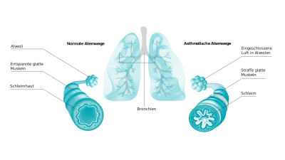 Zuversichtlich-aussehender Arzt an Schreibtisch sitzend mit Vivatmo pro im Hintergrund, hält eine Lungenabbildung als Wetterkarte mit positiven Wert hoch.