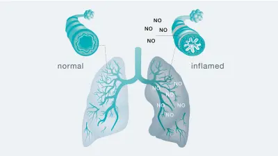 Confident-looking doctor sitting at desk with Vivatmo pro in background, holding up lung image as weather map with positive value.